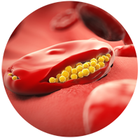 malaria